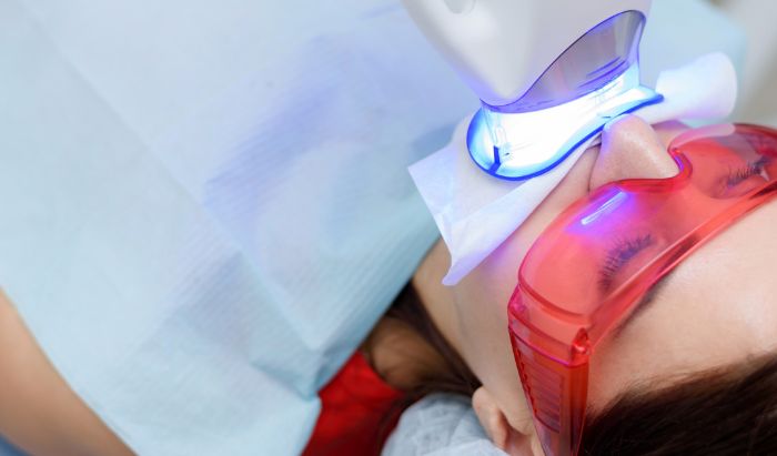 Teeth Whitening From $100 article image