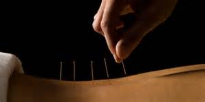 15% OFF Initial Acupuncture Treatment - Partner Offer Image