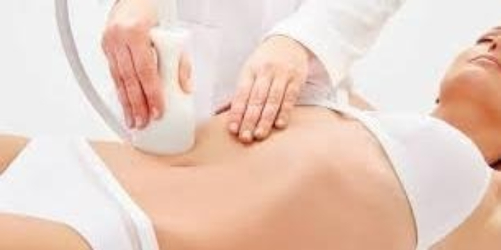 $100 OFF Your First Cryoskin Session offer image