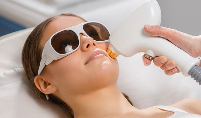 LASER HAIR REMOVAL article image