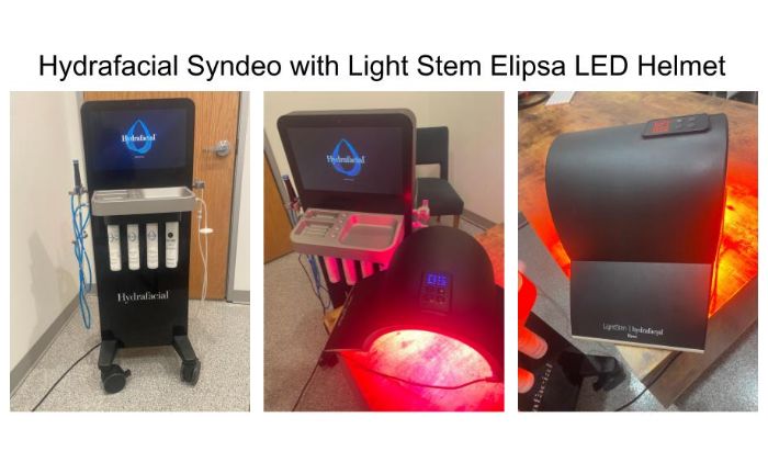 Hydrafacial Syndeo article image