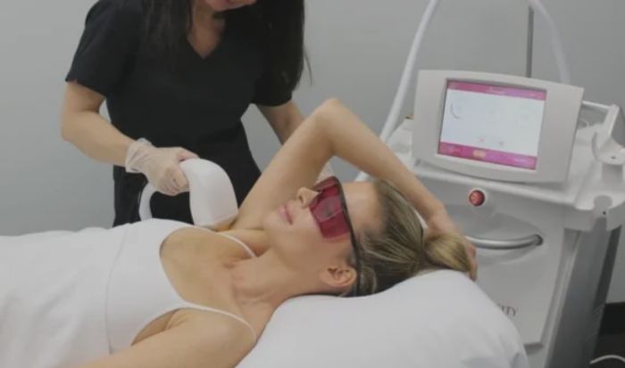 Laser Hair Removal article image