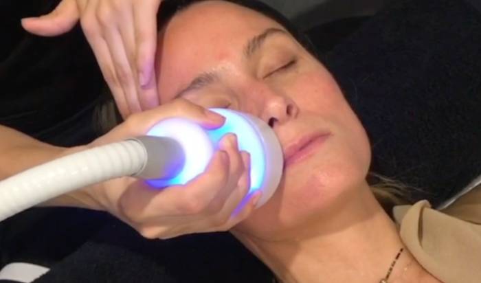 Cryoskin Facials image