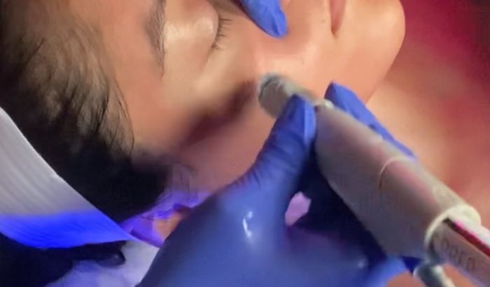 Hydrafacial article image