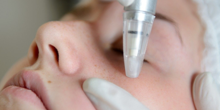 ONLY $98 for One Hour Facial with Microdermabrasion at On the Go VIP Spa - Partner Offer Image
