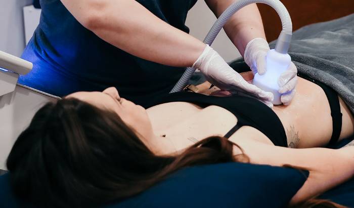 Cryoskin Slimming image