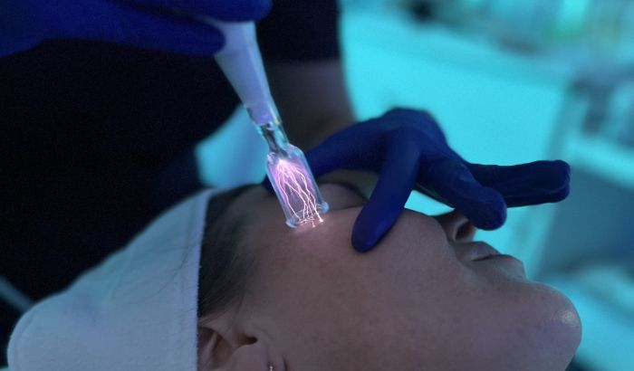 Cold Plasma Treatments — 20% OFF article image