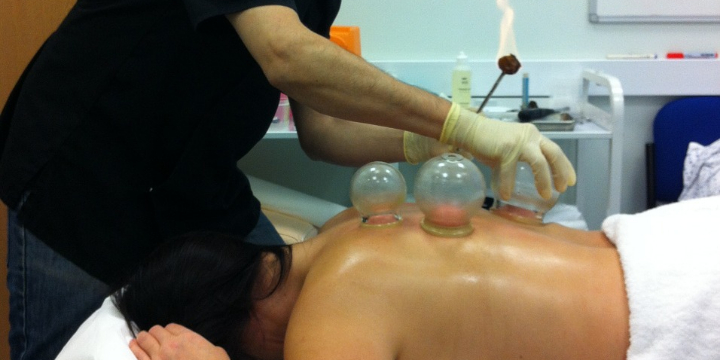 Exclusive Promo: 15 minute Cupping session for ONLY $25! - Partner Offer Image