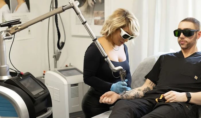 Pico Tattoo Removal article image