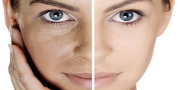 20% off Laser Hair Removal- Women’s Full Face  - Partner Offer Image
