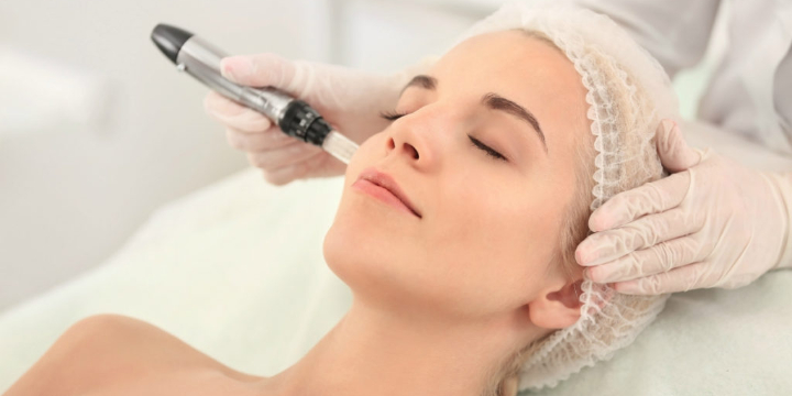 Exclusive $450 for Basic Microneedling at On the Go VIP Spa - Partner Offer Image