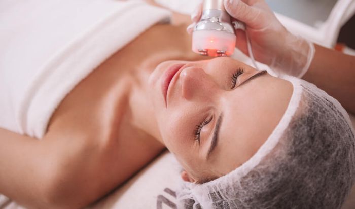 Prices For Bio Microneedling & Collagen Facial article image