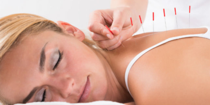 Buy 3 and get your 4th treatment free. (Acupuncture) - Partner Offer Image