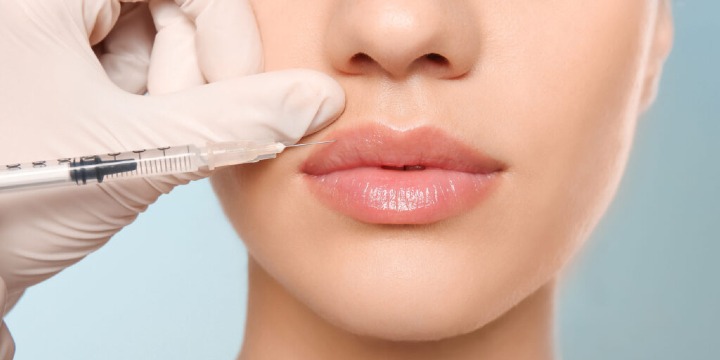 $100 OFF Lip Border Fillers (May 12–17 ONLY!) 💋 offer image
