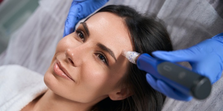 Luxury Glow-up: Microneedling With Salmon DNA or VAMP - Only $450! offer image