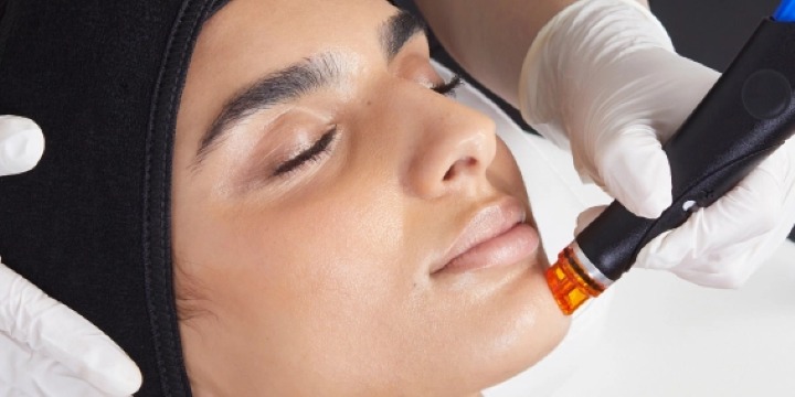 Refer a friend for any skin health service and you BOTH receive a $50 voucher once their service is completed! offer image