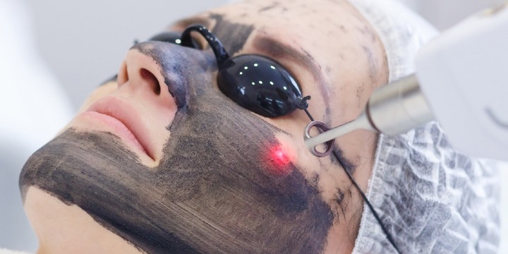 [BLACK FRIDAY PROMO] Hollywood Carbon Laser Facial offer image