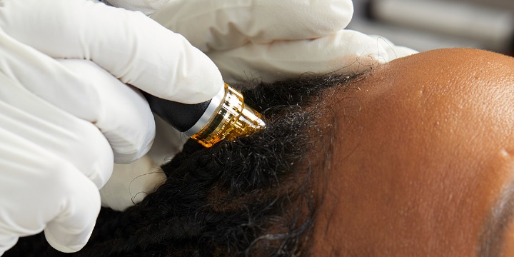 Buy a 3-Pack of Keravive, Get a FREE Scalp Spray + 3 Facials* offer image
