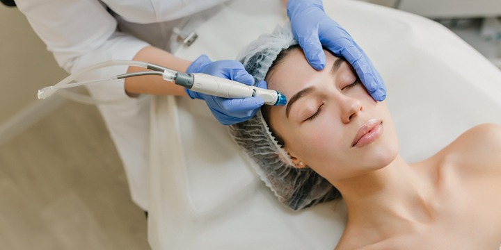 SQT BIO-MICRONEEDLING FACIAL at JUST $179! offer image