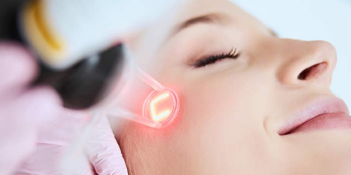 Eye Rejuvenation Bundle: Fotona + PRF – Just $750 (regular $1300) offer image