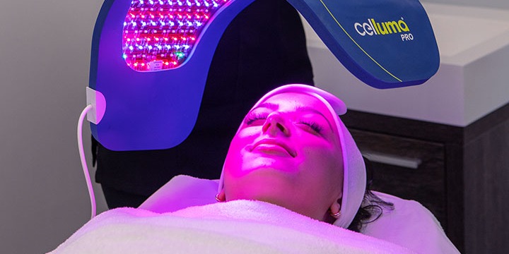 Buy 3 Dermaplaning Sessions for $270 + FREE 4-Pack of Celluma LED Treatments ($100 Value)! offer image