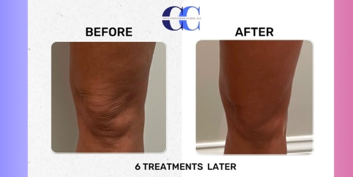 Tuesday 07/08: We got our knees done offer image