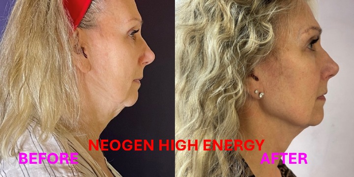 EXCLUSIVE - $100 OFF Neogen  offer image
